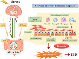 Crohn’s Disease AND Stress Management