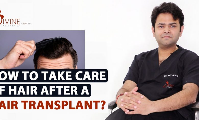 Photo of How to Take Care of Hair after a Hair Transplant?