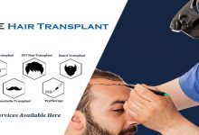 Photo of World’s Most Advanced FUE hair transplant Technique to Regrow Hair Loss