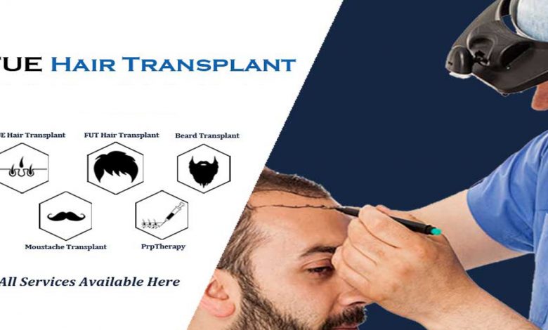 fue hair transplant- World's Most Advanced FUE hair transplant Technique to Regrow Hair Loss