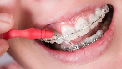 Photo of Invisalign braces south holland for straight teeth in a flash 2021