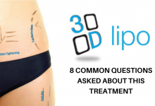 Photo of 3D Lipo – 8 Common Questions Asked About This Treatment