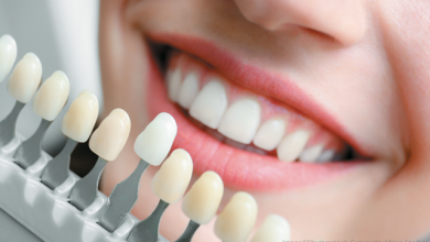 Photo of Different Issues To Be Treated By The Expert Cosmetic Dentist Hobart
