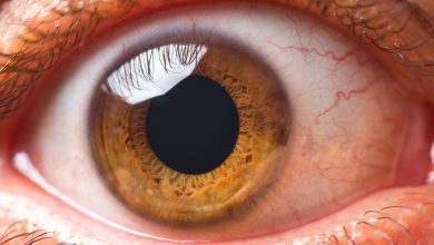 Photo of Things You Should Know About Eye Floaters