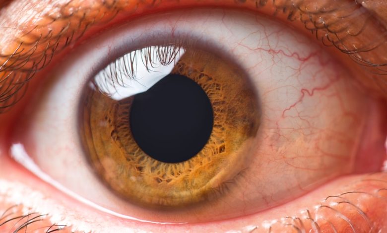 Photo of Things You Should Know About Eye Floaters