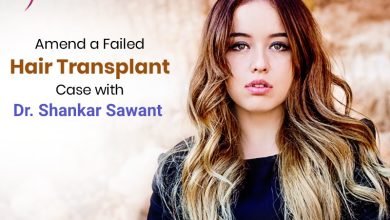 Photo of How restore or amend a failed hair transplant case?