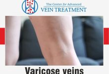 Photo of WHAT ARE 5 TIPS FOR FINDING A GOOD VEIN SPECIALIST?