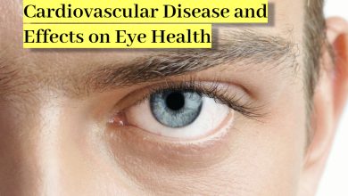 Photo of Cardiovascular Disease and Effects on Eye Health