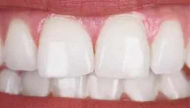 Photo of The Situations in Which You Might Require Emergency Dental Care