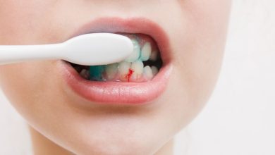 Photo of What Can Cause Bleeding Gums?