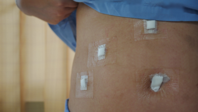 Photo of How long does your stomach stay swollen after gallbladder surgery?
