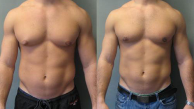 Photo of Breast Growth In Men Surprisingly Common
