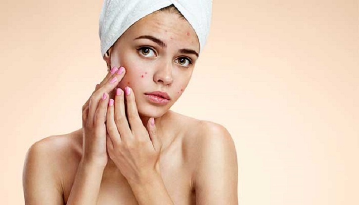 Photo of Oily slick skin – Home remedies