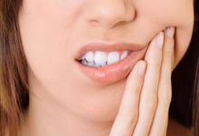 Photo of What problems can occur after Dental implant surgery?
