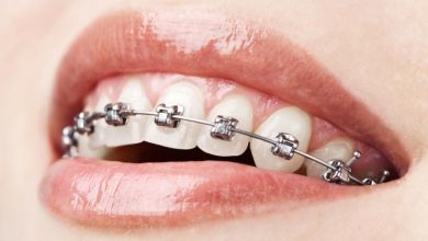Photo of Who Are the Best Orthodontists Near Me?