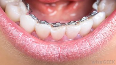 Photo of How To Find the Best Orthodontist Near Me