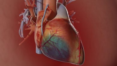 Photo of How can Heart Bypass Surgery treat Heart Problems?