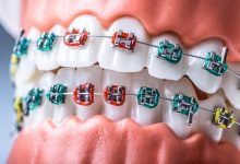 Photo of What is an Orthodontist and What Do They Do?