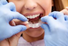 Photo of How to Find an Affordable Orthodontist Near Me