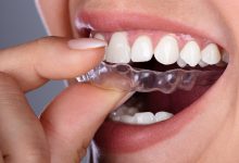 Photo of How To Login And Registration On Invisalign Doctor Site?