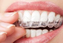 Photo of Invisalign Doctor Site: How To Register And Login