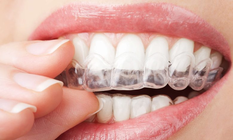 Photo of Invisalign Doctor Site: How To Register And Login