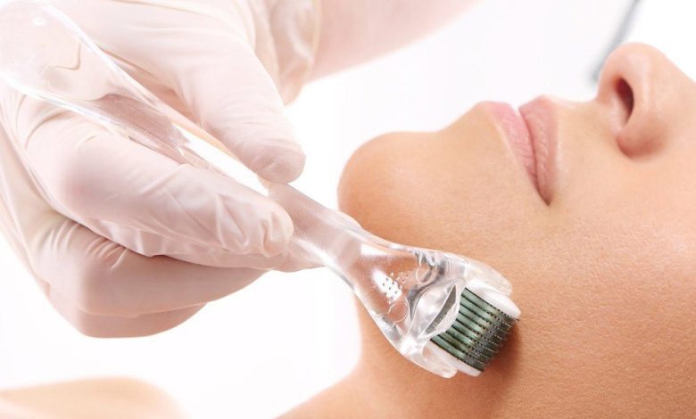 Photo of Microneedling With PRP : Process, Pre, Post Care & Resutls